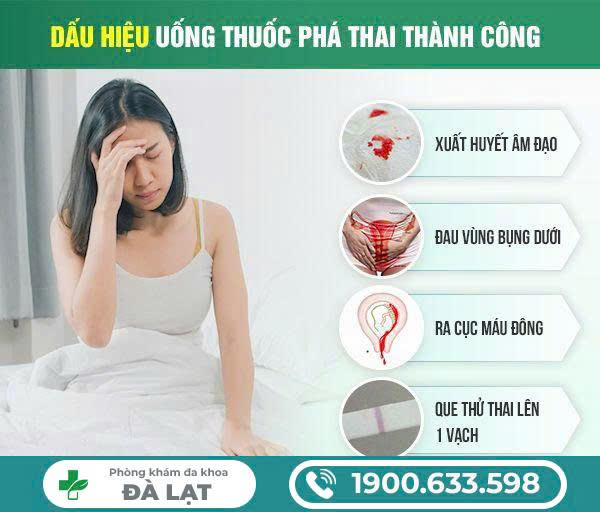 Hình ảnh minh họa